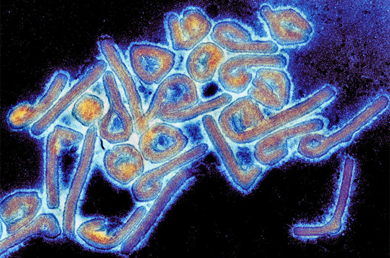 Electron microscope image of Marburg virus