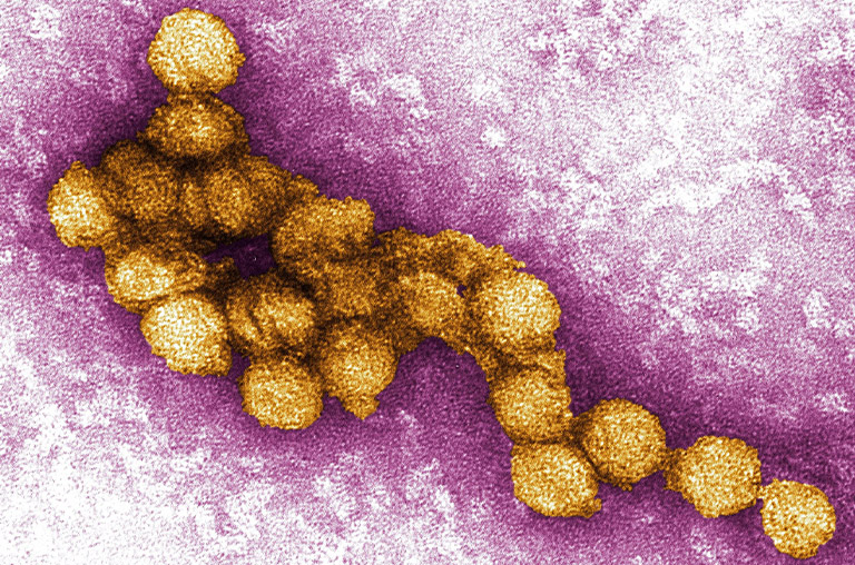 Electron microscope image of West Nile virus.